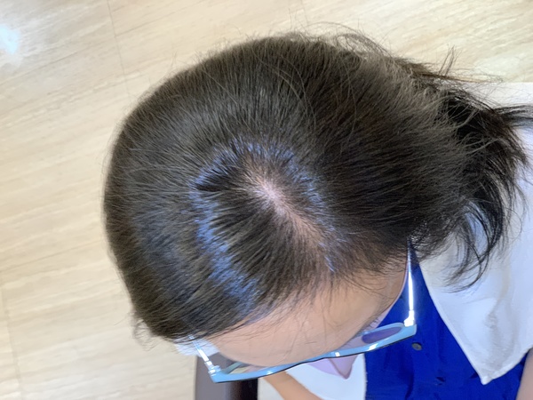 イルミナカラーで白髪染め♪